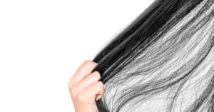 Verschiedene Ursachen von diffusem Haarausfall und Behandlung