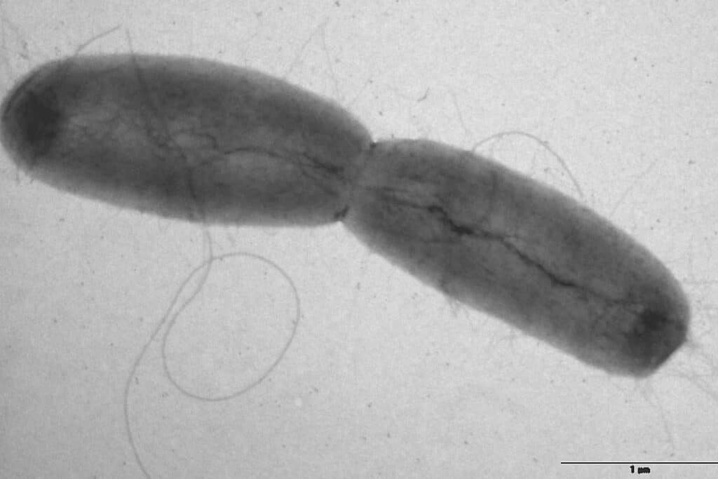 Hainhölzer Bad in Hannover wegen Kolibakterien geschlossen