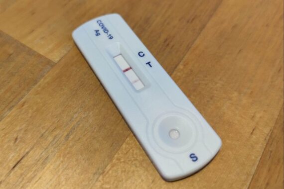 Eine positive Corona-Testanzeige, Symbol für Long Covid und ME/CFS-Herausforderungen in Hamburg.