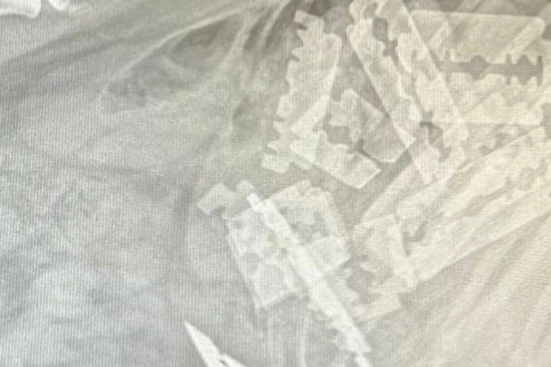 Hund stirbt nach Verzehr von mit Rasierklingen präpariertem Fleisch in Meinerzhagen