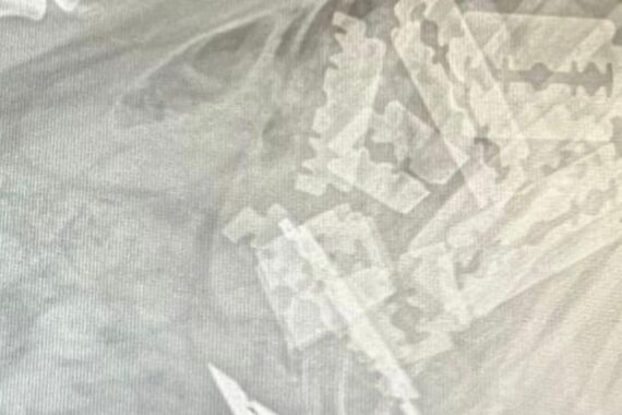 Röntgenbild eines Hundes mit Rasierklingen im Magen, Tierschutzfall in Meinerzhagen.